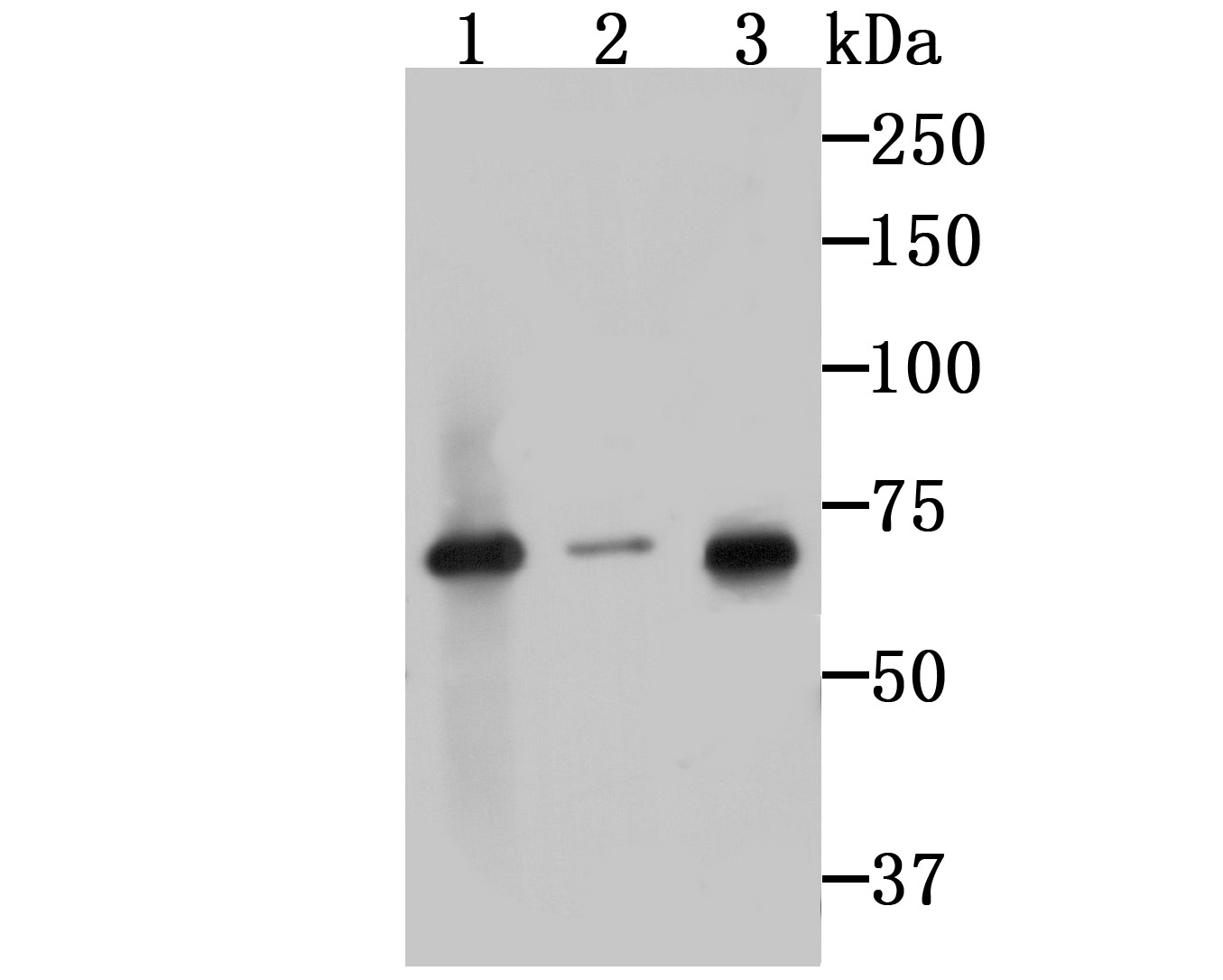 Anti-IRAK2 Antibody (9Y118)