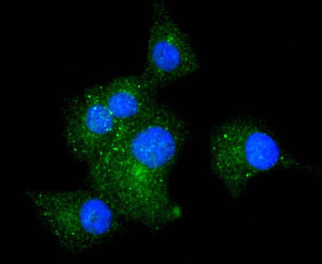 Anti-ITGA5 Antibody (5F909)