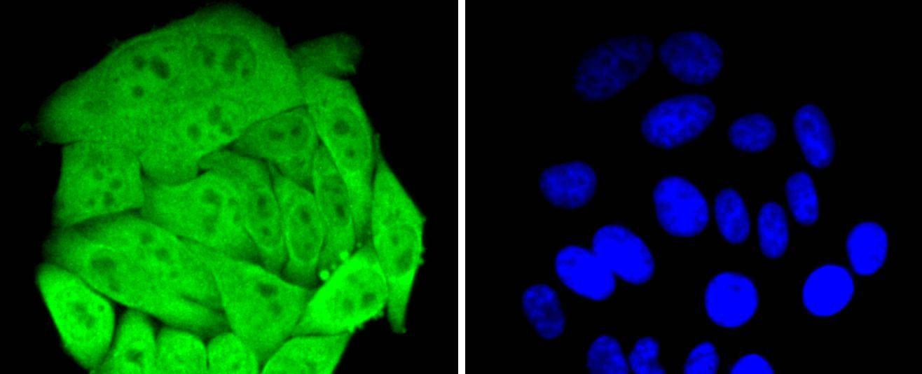 Anti-HSPA4 Antibody (7T809)