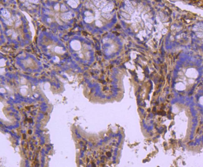 Anti-HSPA2 Antibody (2P492)