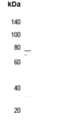 Anti-Phospho-IRAK1 (Thr100) Polyclonal Antibody
