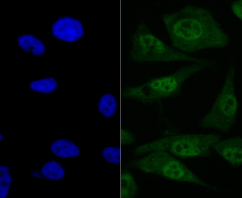 Anti-IRAK2 Antibody (9Y118)