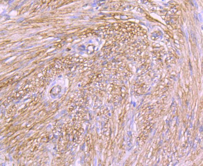 Anti-ITGA5 Antibody (5F909)