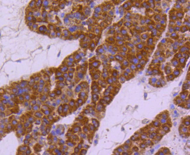 Anti-HSPA4 Antibody (7T809)