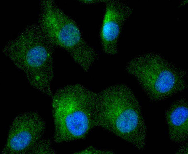 Anti-IkappaB- beta Antibody (5Y651)