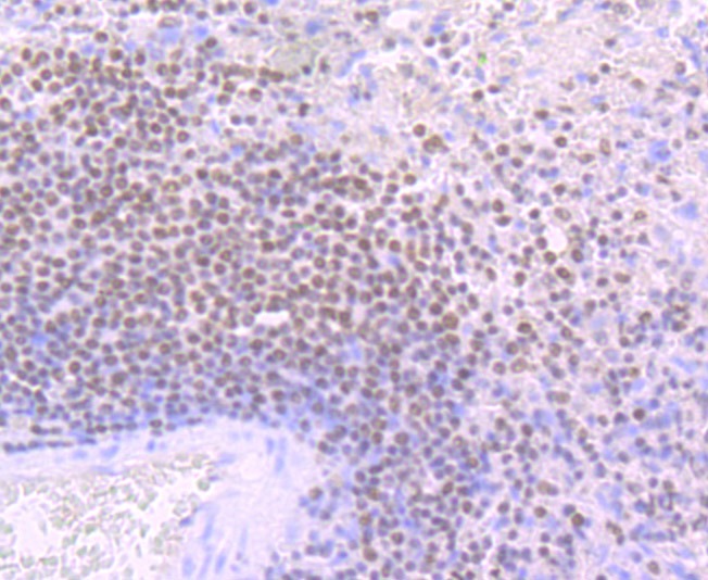 Anti-IKZF1 Antibody (8M494)