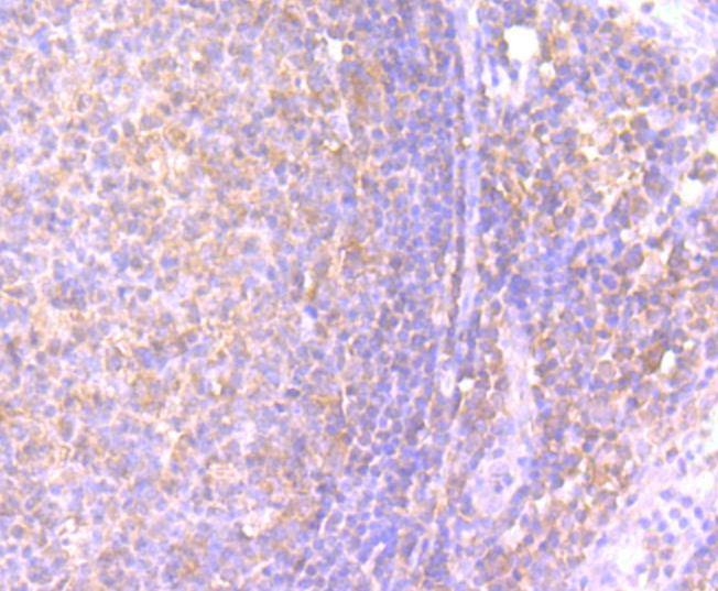 Anti-IFN gamma Antibody (1T875)