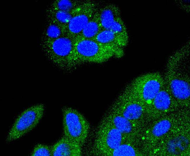 Anti-NFKBIA Antibody (1J77)