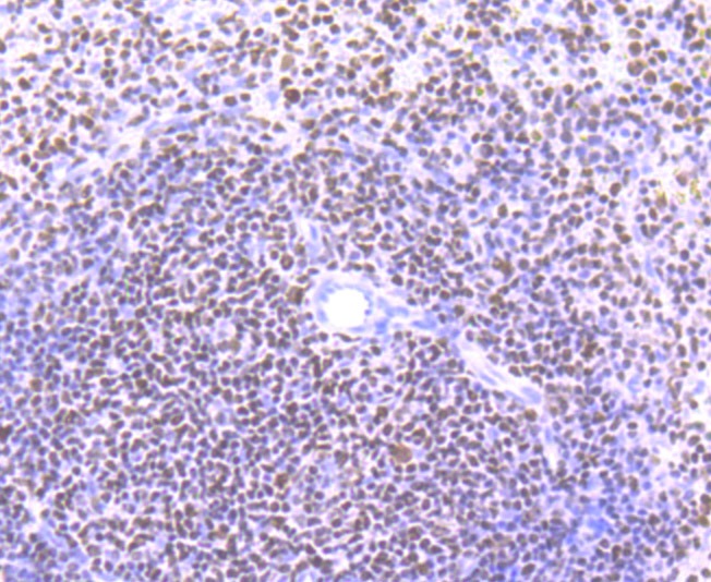 Anti-IKZF1 Antibody (8M494)
