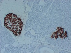 Anti-Insulin Antibody (3U693)