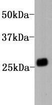 Anti-Human IgG kapa light chain Antibody (8U191)