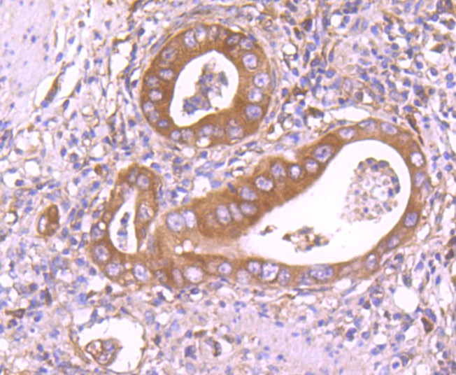 Anti-IDE Antibody (5U690)
