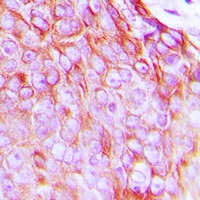 Anti-Phospho-Insulin Receptor (Tyr1361) Polyclonal Antibody 2