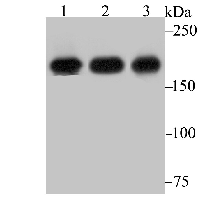 Anti-IQGAP1 Antibody (5T212)