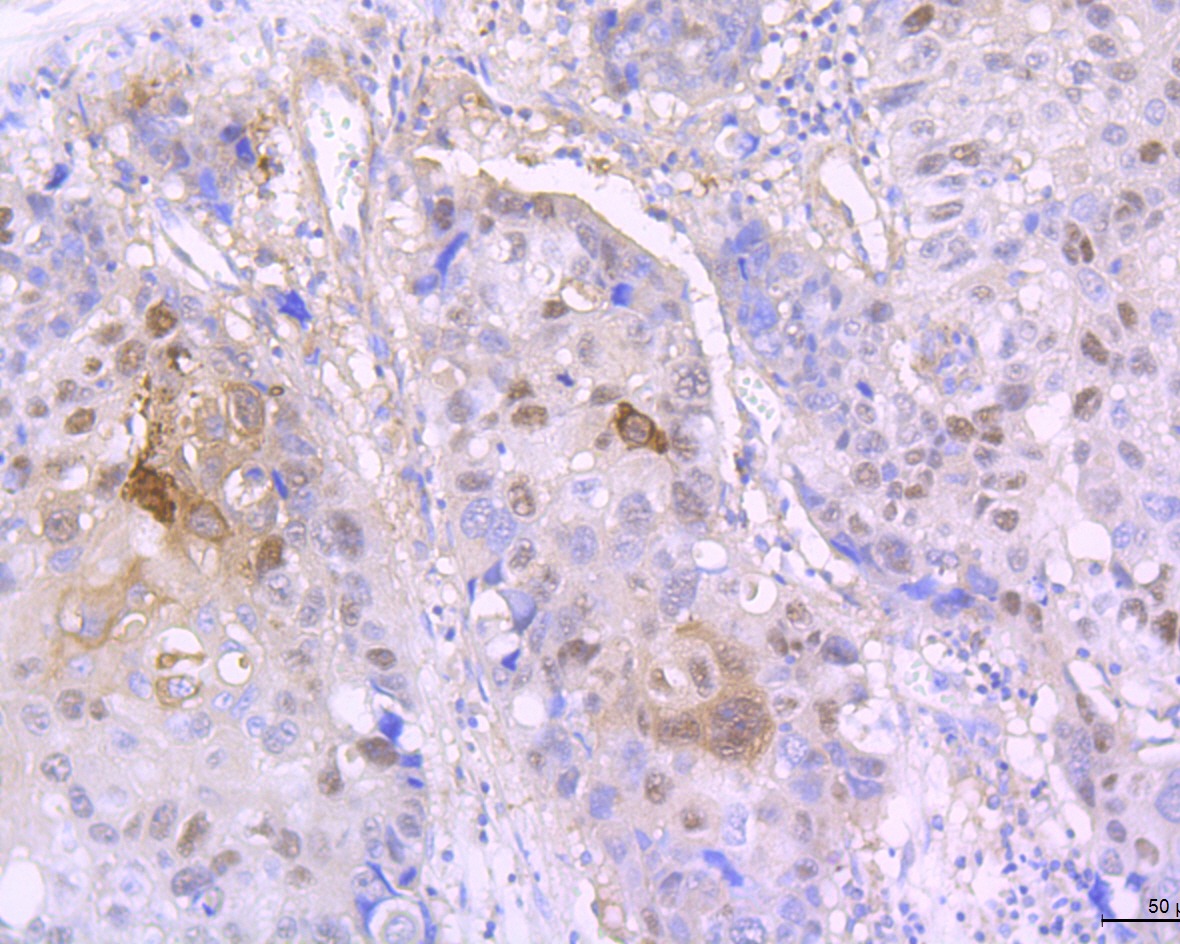 Anti-Involucrin Antibody (8Q256)