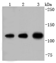 Anti-IDE Antibody (5U690)
