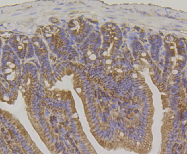 Anti-IQGAP1 Antibody (5T212)
