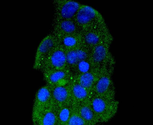 Anti-HSPA14 Antibody (8Q329)
