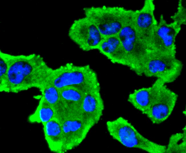 Anti-Insulin Receptor Antibody (5X84)