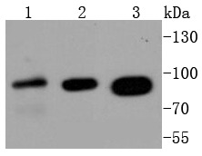 Anti-Insulin Receptor Antibody (5X84)