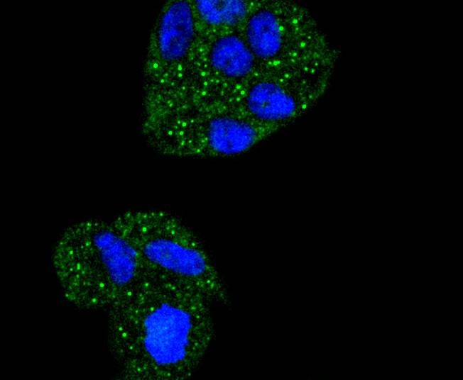Anti-NFKBIA Antibody (1J77)