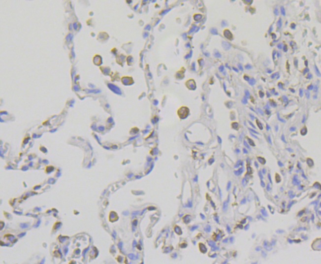 Anti-IQGAP1 Antibody (5T212)