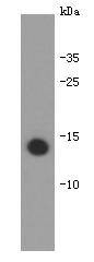 Anti-IL-31 Antibody (2D675)