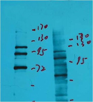 Anti-IDE Antibody (7S578)
