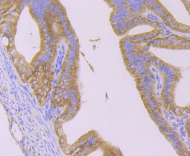 Anti-HTT Antibody (6D662)
