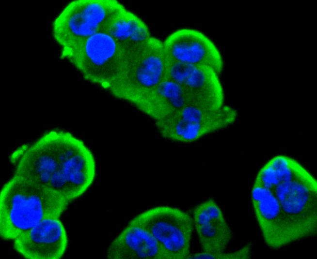 Anti-Insulin Receptor Antibody (5X84)