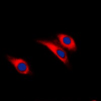 Anti-Phospho-Insulin Receptor (Tyr1361) Polyclonal Antibody 2