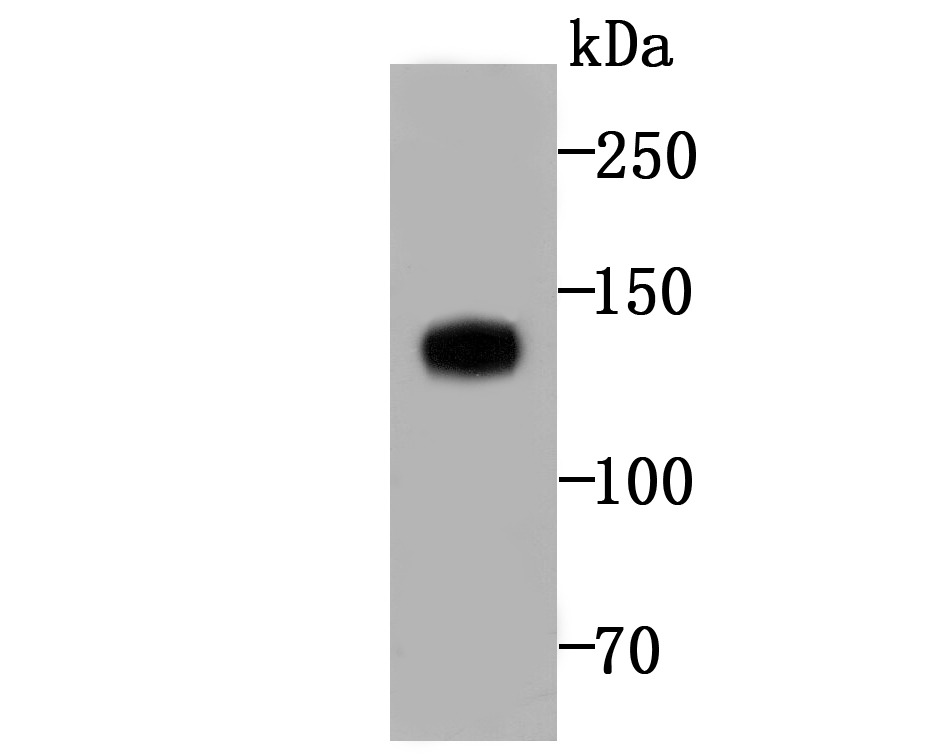 Anti-Involucrin Antibody (8Q256)