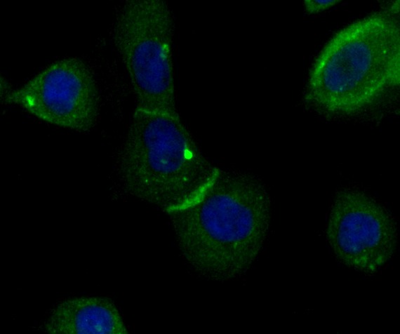 Anti-IQGAP1 Antibody (5T212)