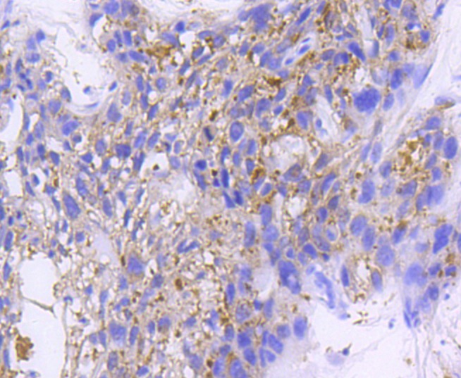 Anti-IkappaB- beta Antibody (5Y651)