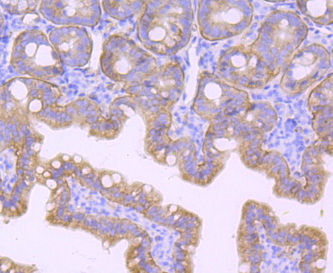 Anti-ITGB4 Antibody (3G397)
