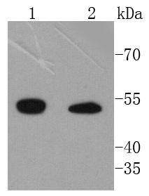 Anti-ILK Antibody (9I91)