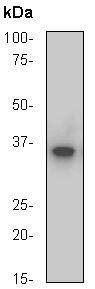 Anti-NFKBIA Antibody (9N642)
