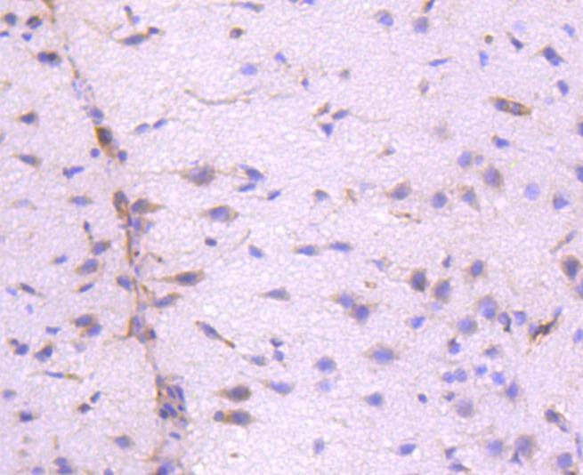 Anti-ILK Antibody (9I91)
