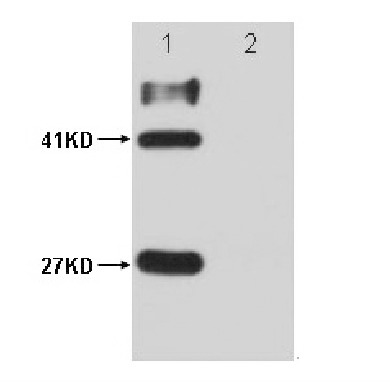 Anti-HSV Tag Antibody (5Z398)