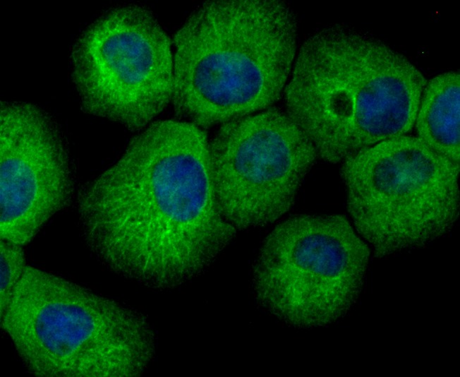 Anti-hUPF1 Antibody (4P615)