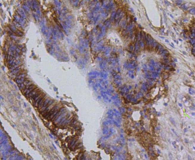 Anti-ITGB1 Antibody (1M683)