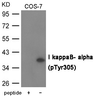 Anti-Phospho-NFKBIA (Tyr305) Polyclonal Antibody 2