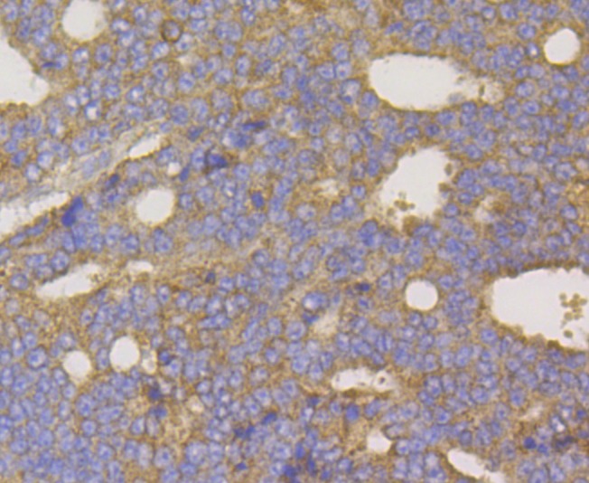 Anti-hUPF1 Antibody (4P615)