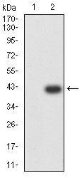 Anti-Ig lambda constant 2 Antibody (9U628)
