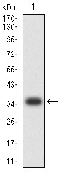 Anti-Ig lambda constant 2 Antibody (9U628)