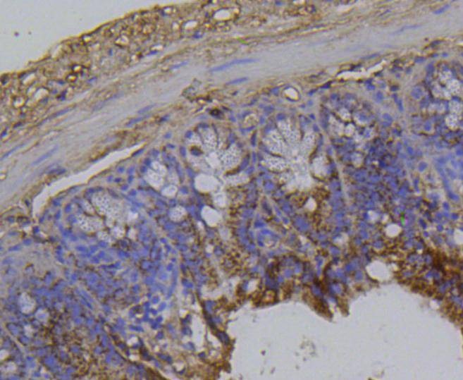 Anti-ITGB1 Antibody (1M683)