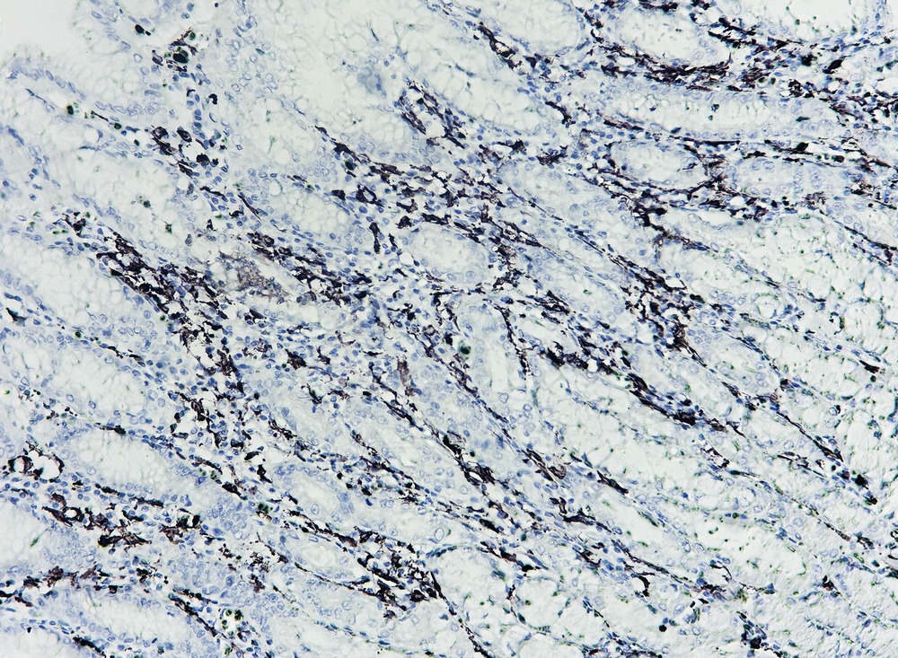 Anti-Iba1 Antibody (3E909)