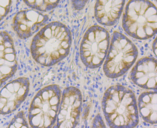 Anti-hUPF1 Antibody (4P615)