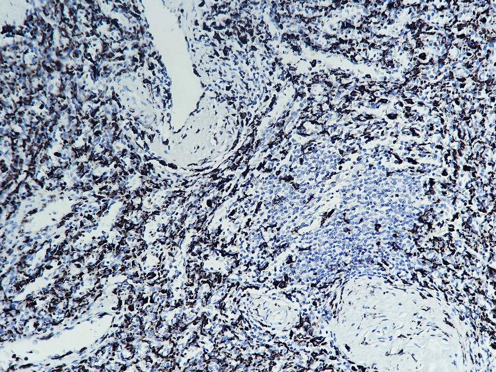 Anti-Iba1 Antibody (3E909)
