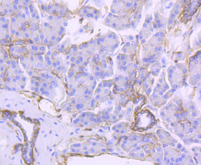 Anti-ITGB4 Antibody (3G397)
